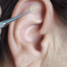 Selbstheilungsprozesse mit Ohrakupunktur oder Ohrakupressur anregen KOPFSCHMERZEN